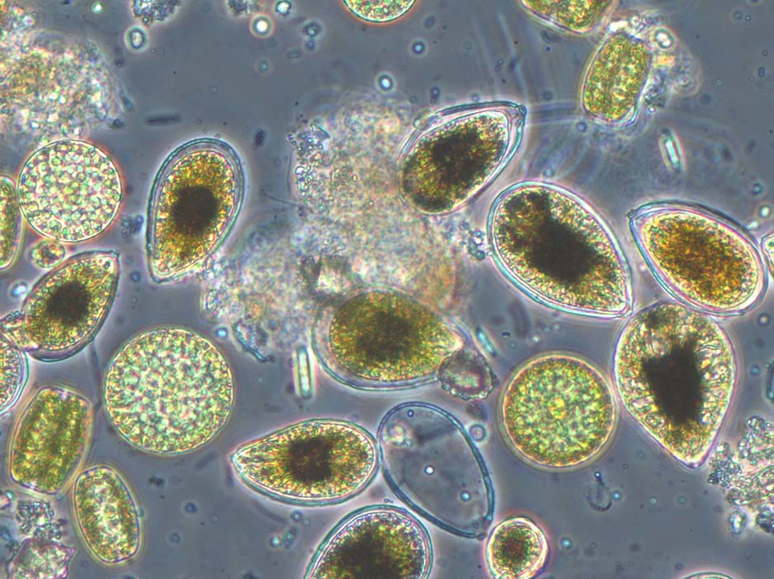 Ostreopsis : vue microscopique, par Hubert Grossel (IFREMER)